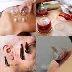 دوره آموزش حجامت زالو درمانی و بادکش