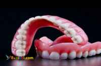 دندانسازی ارزان در تهرانسر