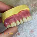 ساخت انواع دندان مصنوعی