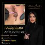 قیمت ریموو تاتو هزینه نهایی پاک کردن تاتو با ریموور