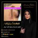 آموزش ریموو تاتو مشکی از صفر تا صد با مدرک رسمی 