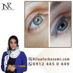 آموزش ریموو تاتو خط چشم با کمک مواد