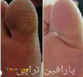 آموزش و انجام پارافین تراپی( دست،پا و صورت)